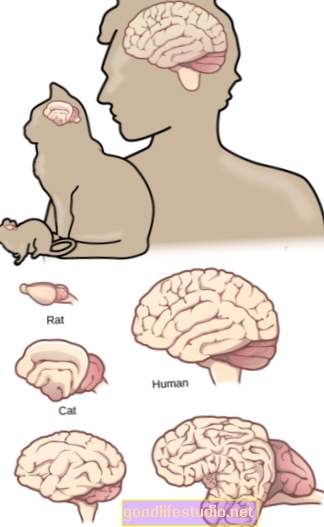 Velikost oblastí mozku svázaných s časným Alzheimerovou chorobou