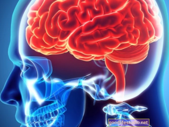 Région cérébrale spécifique liée à l'excitation et à la réactivité dans le SSPT
