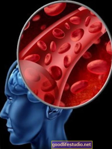 دراسة التوائم توفر دليل بروتين الدم لمرض الزهايمر