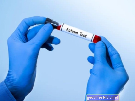 Une étude reproduit l'efficacité du test sanguin pour l'autisme
