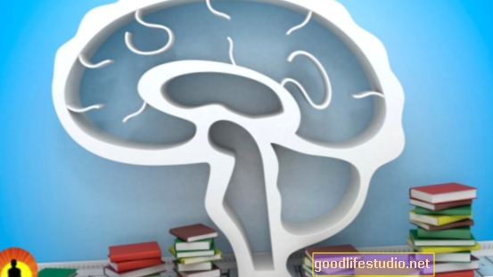 Studie: Specifická forma péče o zobrazování mozku pro Alzheimerovu chorobu