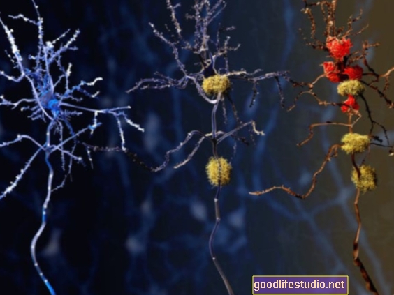 „Super-Agers“ zeigen Resistenz gegen an Alzheimer gebundene Proteine