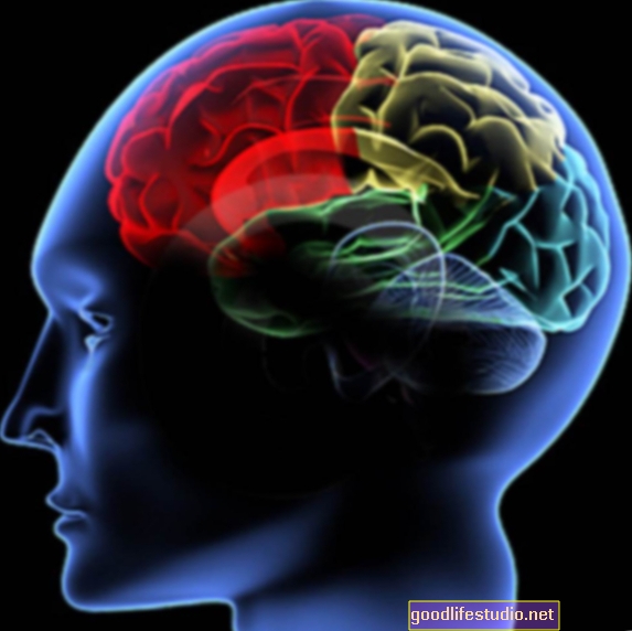 Menapis Pemikiran Otak ‘Penapis’ Boleh Membolehkan Lebih Banyak Kreativiti