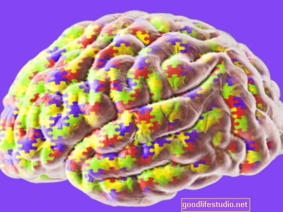 روابط الدماغ المستمرة المرتبطة بأعراض التوحد