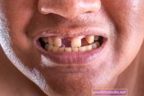 Zahnverlust in Verbindung mit Abnahme des Gedächtnisses und der Gehgeschwindigkeit