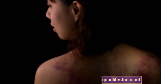 تواجه النساء اللائي ينجحن من العنف المنزلي مخاطر مضاعفة للإصابة بأمراض طويلة الأمد