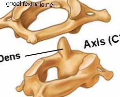 Расстройства верхних отделов шейного отдела позвоночника: анатомия головы и верхней части шеи