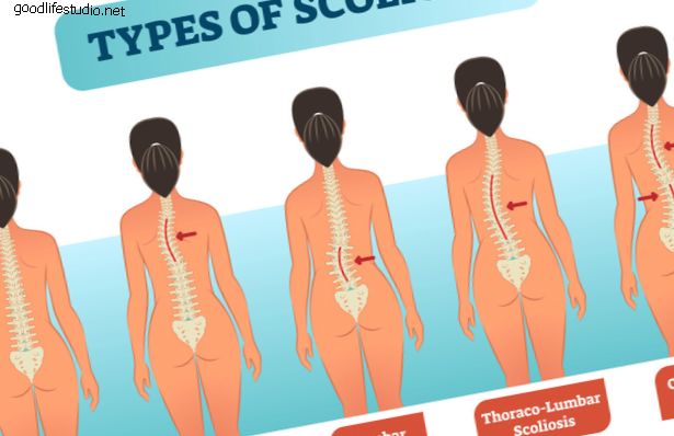 Los síntomas de la escoliosis