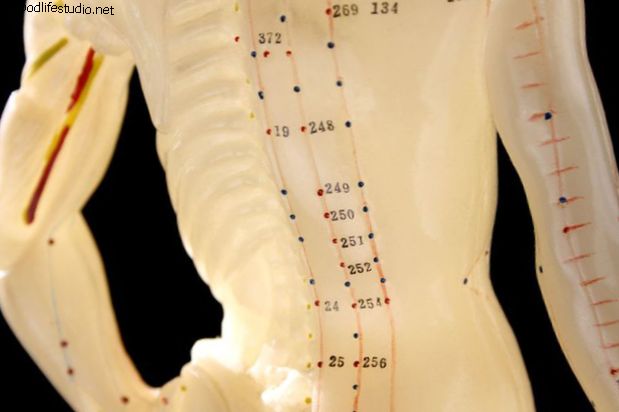坐骨神経痛の代替治療：鍼、指圧、バイオフィードバック、ヨガ