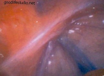 minimalno invazivna operacija kralježnice, unutar stijenke prsnog koša