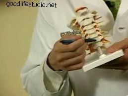 Chirurgie bei Nackenschmerzen: Ersatz der künstlichen Bandscheibe