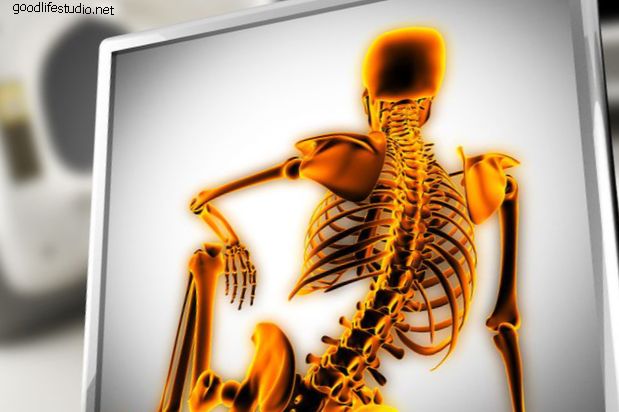 Stimulasi Kord tulang belakang: Kelebihan dan Risiko dan Siapa Calon?