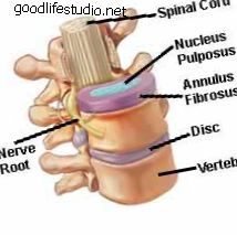 disc normal, vertebre, nervi