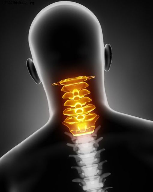 Opzioni di rinforzo della colonna vertebrale cervicale: anello Halo, corone o gilet