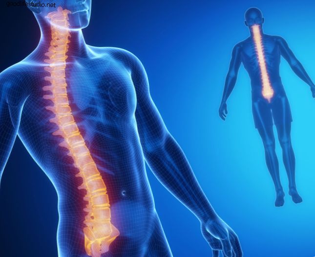 Preguntas frecuentes sobre la estimulación de la médula espinal
