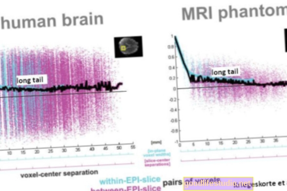 Viele fMRI-Studien „Grundlegend fehlerhaft“