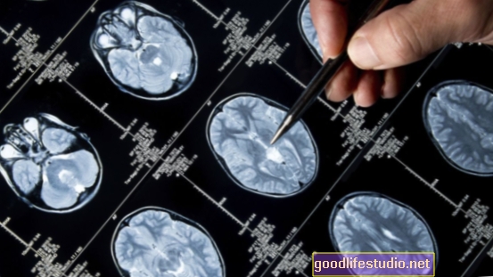 Nový výzkum: Mozek a morální vývoj